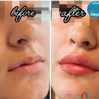 تخفیف ویژه خدمات پوست و مو به مناسبت روز  پزشک|خدمات آرایشگری و زیبایی|کرمانشاه, |دیوار