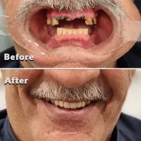 دندانپزشکی لمینت اقساط زیبائی کامپوزیت ارتودنسی|خدمات آرایشگری و زیبایی|مشهد, سجاد شهر|دیوار