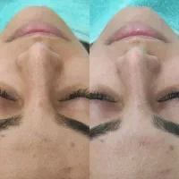 تخفیف ویژه پاکساژی و ماساژ صورت|خدمات آرایشگری و زیبایی|سقز, |دیوار