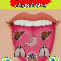 درمان با طب سنتی