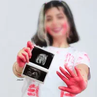 عکاسی بارداری،تایین جنسیت،تولد و