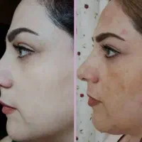 کرم شب vipملکه . صابون کوجی سان .گلوتاتیون اصل|آرایشی، بهداشتی، درمانی|کرمان, |دیوار