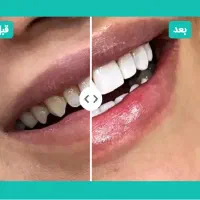 کامپوزیت اقساطی هر واحد 3 میلیون تومان