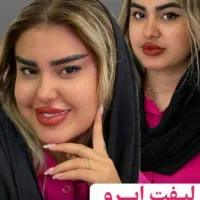 جراحی لیفت ابرو،دایرکت ابرو،لیفت شقیق ،پیشانی|خدمات آرایشگری و زیبایی|تهران, پاسداران|دیوار