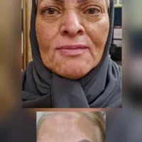 روغن خوراکی|خوردنی و آشامیدنی|برهسر, |دیوار