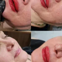 جوانسازی و شیدینگ لب حرفه ای