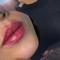 ژل وبوتاکس ومزونیدلینگ وحجامت|خدمات آرایشگری و زیبایی|فولادشهر, B2|دیوار