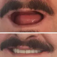 دندانسازی(دندان مصنوعی)|خدمات آرایشگری و زیبایی|اصفهان, وحید|دیوار