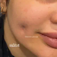 خدمات تخصصی پیرسینگ|خدمات آرایشگری و زیبایی|شیراز, خلدبرین|دیوار