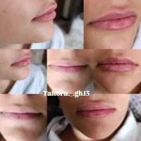 مدل ژل بوتاکس و پیرسینگ