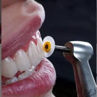 خدمات دندانسازی و دندانپزشکی