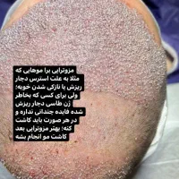 کاشت موکاشت ابرو+ اموزش کاشت مو نقد، اقساط تضمینی|خدمات آرایشگری و زیبایی|شیراز, عفیف‌آباد|دیوار