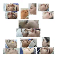 آموزش فیشال