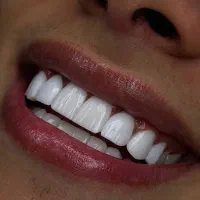 مشاور دنداپزشکی