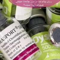 بوتاکس|خدمات آرایشگری و زیبایی|کارون, |دیوار