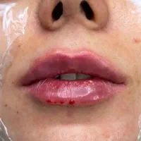جشنواره تخفیف کلینیک لیان