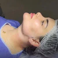جراحی پلک وغبغب/نخ لیفت وکلاژن/فیلر/چربی/ژل ۴۹۰|خدمات آرایشگری و زیبایی|کرج, گوهردشت|دیوار