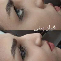تزریق ژل بوتاکس نخ ...توسط پزشک در کلینیک سایماه|خدمات آرایشگری و زیبایی|کرمان, |دیوار