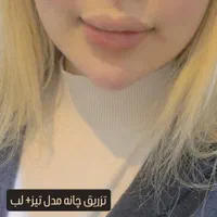 ژل، بوتاکس،آنزیم،مزوتراپی پی ار پی،فیلر بادی|خدمات آرایشگری و زیبایی|اهواز, گلستان|دیوار