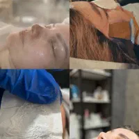 فیشال و جوانسازی پوست|خدمات آرایشگری و زیبایی|قائمشهر, |دیوار