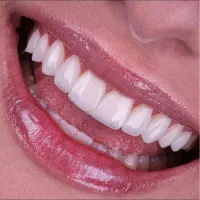 جشنواره زیبایی و درمانی دندانپزشکی کوثر