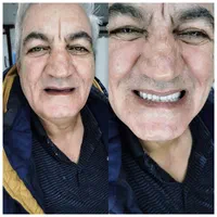 جشنواره دندان مصنوعی خارجی ژله ای با بیمه وضمانت|خدمات آرایشگری و زیبایی|کرج, مصباح|دیوار