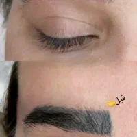 ورکشاپ آموزشی انواع ریموو (پاک کردن تتو)