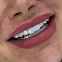 دستیار و پزیرش دندانپزشکی