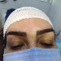 کاشت ابرو دائم قسطی اقساط