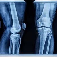 خدمات پرستاری پزشک درمنزل تزریقات سرم تراپی کل شهر|خدمات آرایشگری و زیبایی|مشهد, احمدآباد|دیوار