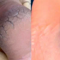 خدمات کاشت ناخن ( پدیکور ومانیکور)
