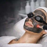 «پیلینگ کربن صورت (هالیوودی)»