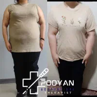 ۴ تا ۱۰ کیلو لاغری فقط در یک ماه در کلینیک