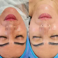 وقت مراقبت از پوستته(پاکسازی،پلاژن تراپی اسیدتراپی|خدمات آرایشگری و زیبایی|بابل, |دیوار