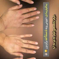 آف فیلر بادی سینه باسن بیکینی دست لاغری شکم Drزنان|خدمات آرایشگری و زیبایی|مشهد, هفت تیر (حافظ)|دیوار