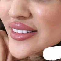 آف ویژه خدمات ژل و بوتاکس به مدت یک هفته