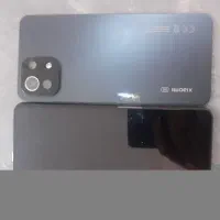 شیائومی mi11 لایت