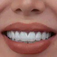 دندانپزشکی، کامپوزیت، عصب کشی، روکش