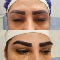 کاشت ابرو دائمی/جراحی پلک(بلفاروپلاستی)|خدمات آرایشگری و زیبایی|تهران, پونک|دیوار