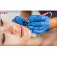 الکترولیز موی زائد بانوان