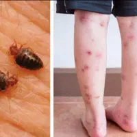 سمپاشی سوسک|خدمات نظافت|کردکوی, |دیوار