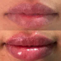 کلینیک تخصصی پوست و زیبایی|خدمات آرایشگری و زیبایی|شیراز, ارم|دیوار