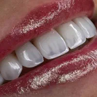 کامپوزیت لبه شیشه ای