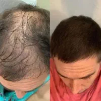 فقط تو دو ماه دربیار موهاتو