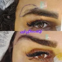 کلینیک زیبایی(تزریقات ژل و چربی/جراحی های سرپایی)