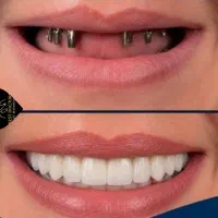 مرکزفوق تخصصی ایمپلنت دیجیتال/سبک کاخ لبخند/یکروزه