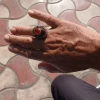 انگشتر مـو کـل