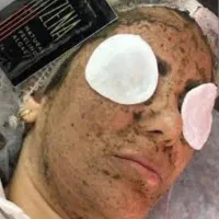 تکنیک پوست مار یا الگاپیل، اسپیکول تراپی|خدمات آرایشگری و زیبایی|شیراز, فضل‌آباد|دیوار