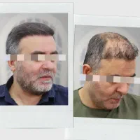 محصول معجزه اسا رویش مجددمو و ضدریزش در 83 روز|آرایشی، بهداشتی، درمانی|تهران, سعادت‌آباد|دیوار