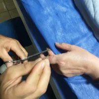 خدمات پرستاری و تزریقات در منزل محمودآباد|خدمات آرایشگری و زیبایی|محمودآباد, |دیوار